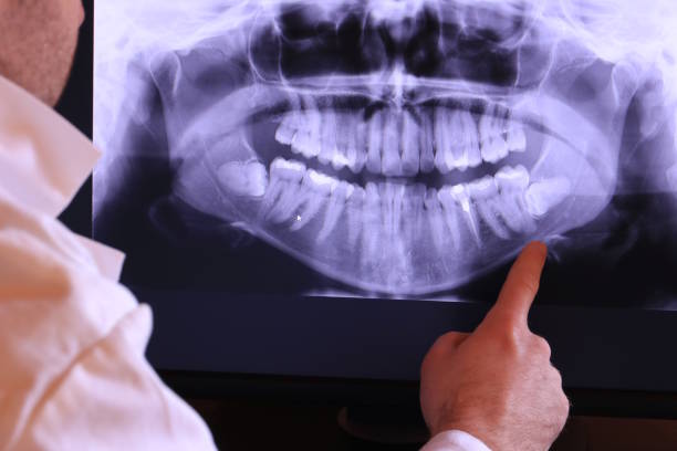 Best Emergency Root Canal Treatment in Mulino, OR